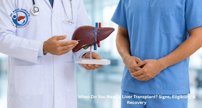 When Do You Need a Liver Transplant? Signs, Eligibility & Recovery